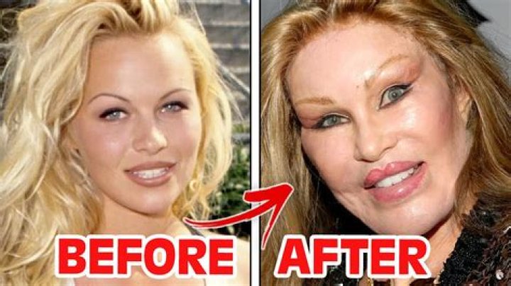 Not Plastic Surgery – Hollywood Life